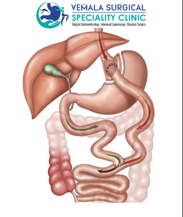 Gastrointestinal Surgeon in Jayanagar