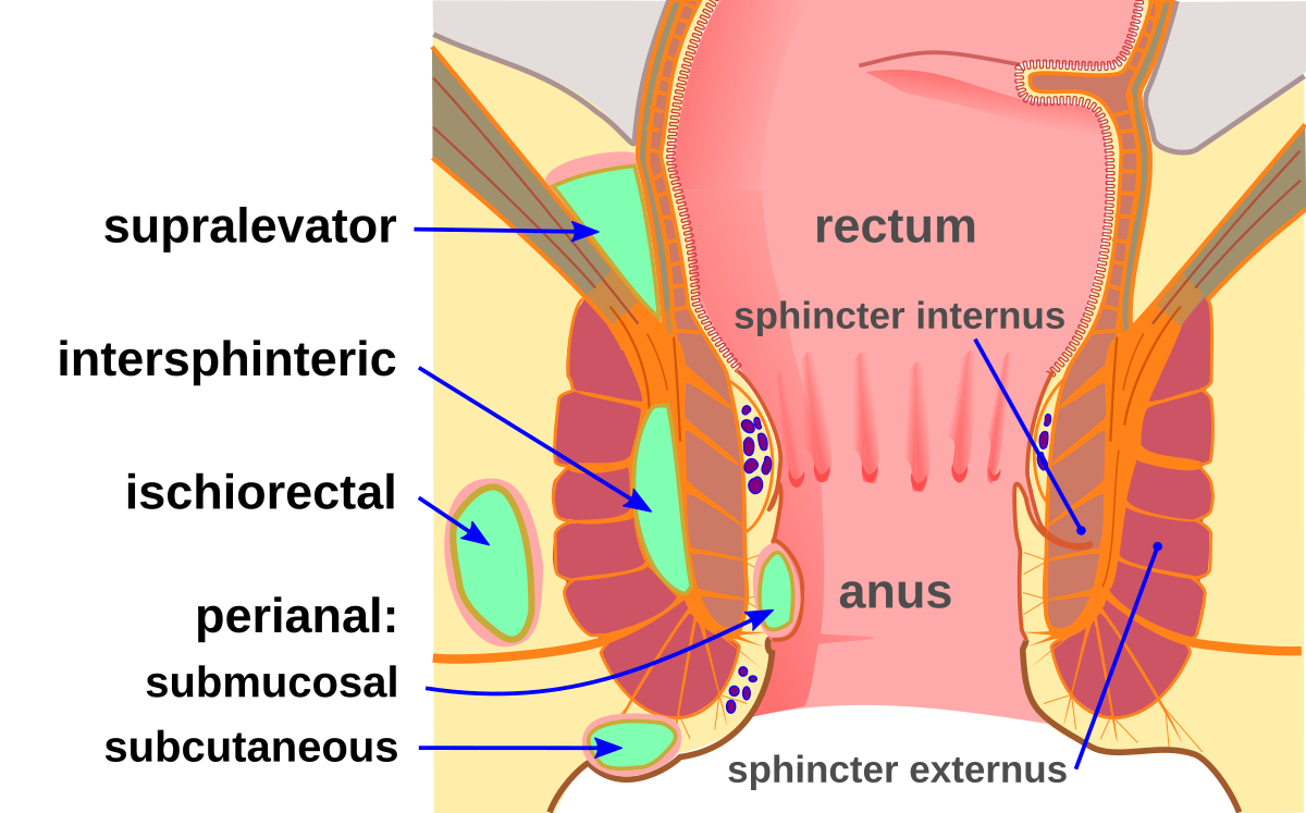 Perianal & Ischiorectal Abscess