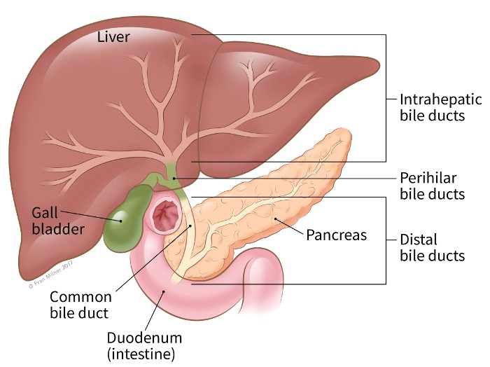 Bile Duct Excision for Tumours and Cancers